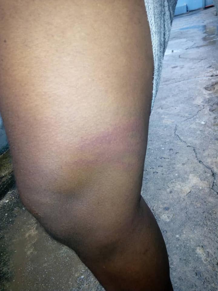 80.2-Kofi-Bartels My Ordeal at the Hands of SARS (Police) Men - Kofi Bartels